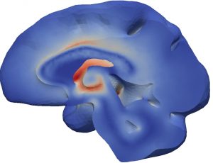 brain