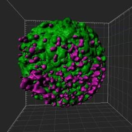 Image showing a breast cancer spheroid (green) being penetrated by fluorescently labelled T lymphocytes (magenta) that have been pre-treated with anti-PD-1 (Nivolumab).