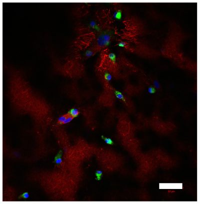 Image of CD68-positive iPS-derived macrophages (green) and fibronectin (red), deposited in stromal compartment of the model. Nuclei are stained in blue