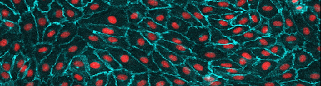 131215_VE-Cadherin_day4.lif_Series015Snapshot1_ch00_smaller