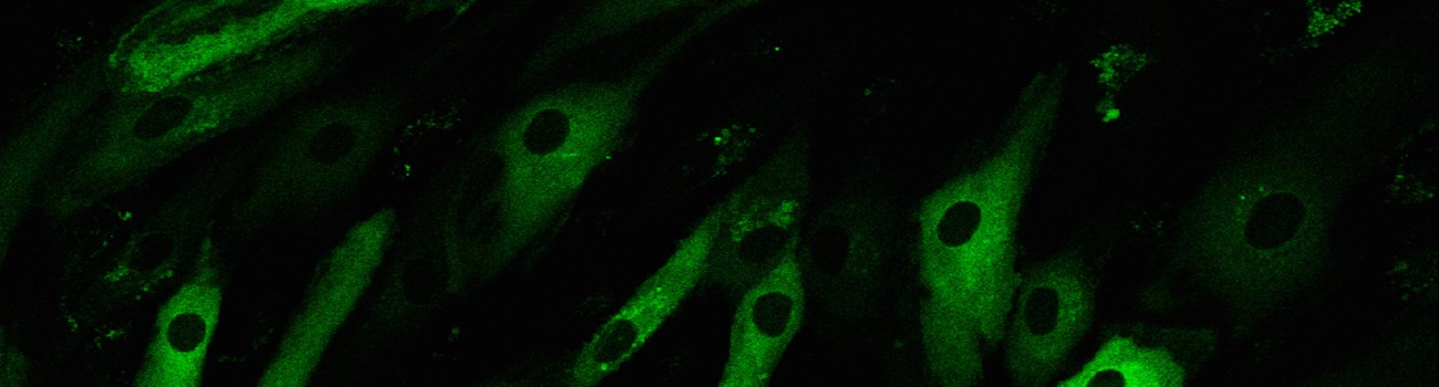 030216_day3_GFPRelA_HUVEC_G418.lif_Image029Snapshot2_ch00 copy