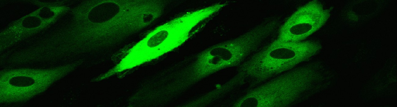 040216_day4_G418_nfkbplasmid.lif_Image029Snapshot2_ch00